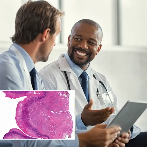 Take Your Next Step with  Urology Centers of Alabama 

